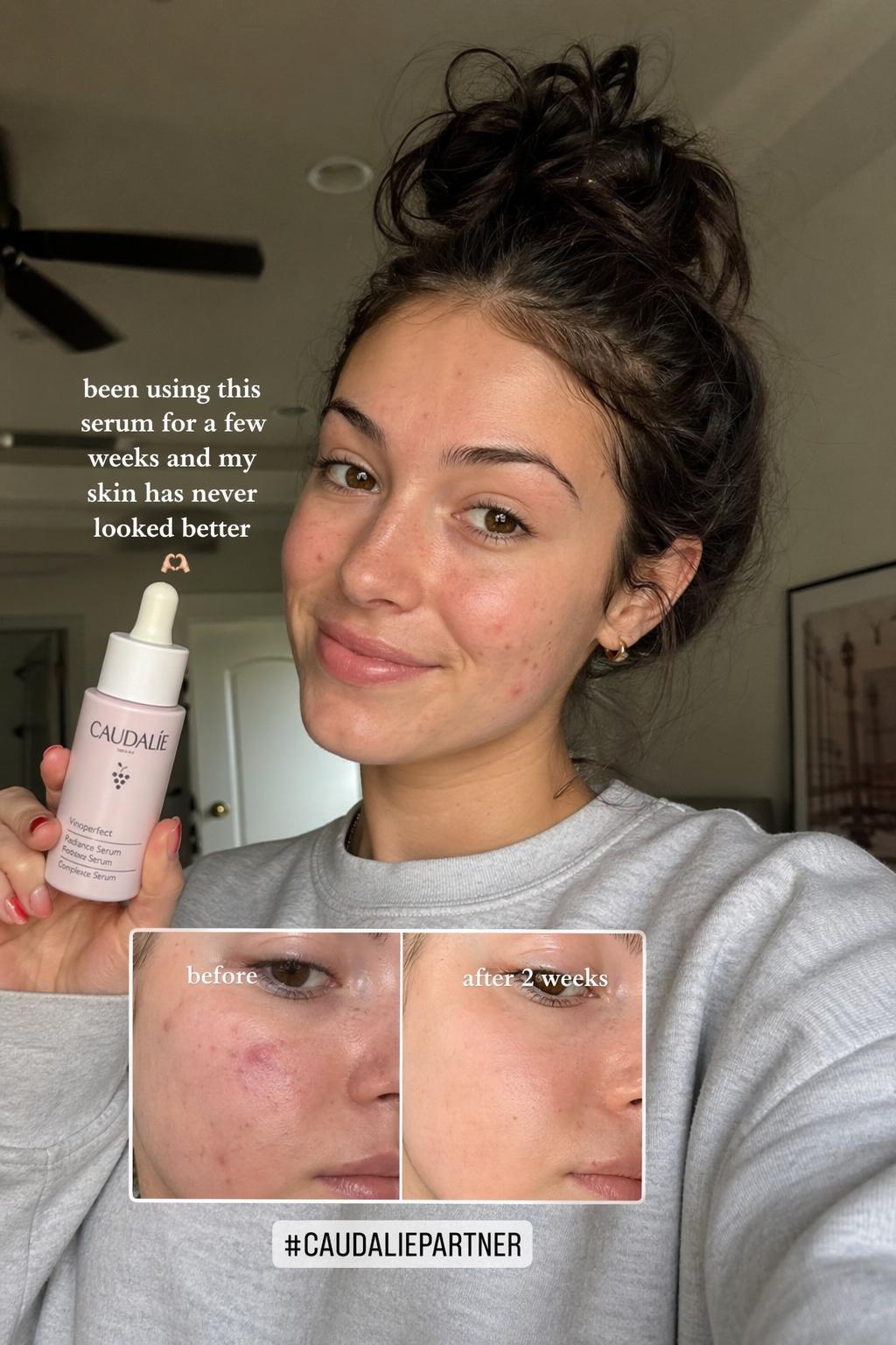 Kunde teilt Produktergebnisse in sozialen Medien